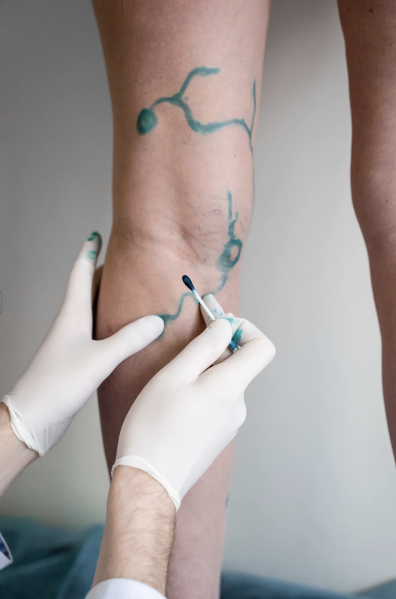 Specialista in Chirurgia vascolare
