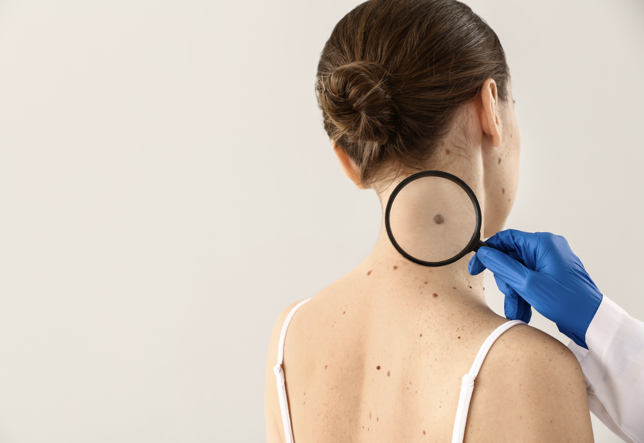 Specialista in Dermatologia